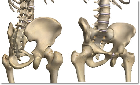 腰割と股関節周囲解剖図：人体解剖3Dサイト「ZygoteBody」とその使い方など（６）：タイトル画像：町の按摩さん.com